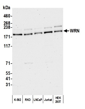 Rabbit anti-WRN Antibody