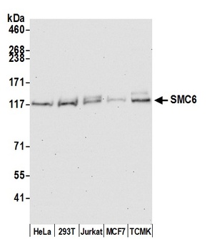 SMC6 Antibody