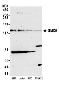 SMC5 Antibody