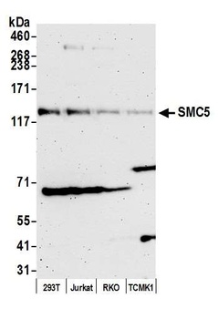 Rabbit anti-SMC5 Antibody