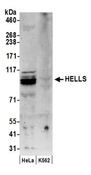 Rabbit anti-HELLS Antibody