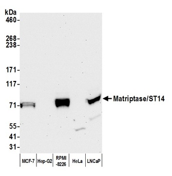 Matriptase/ST14 Antibody