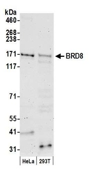 Rabbit anti-BRD8 Antibody