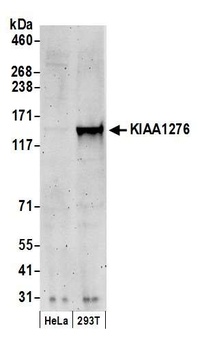 KIAA1276 Antibody