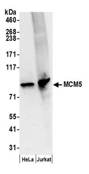 MCM5 Antibody