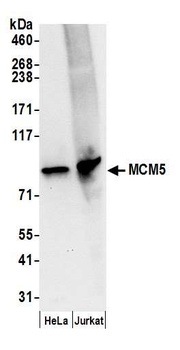 Rabbit anti-MCM5 Antibody