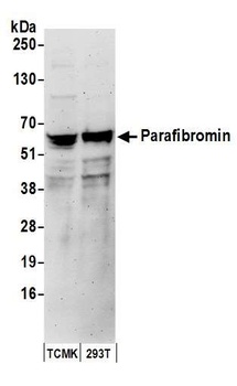 Parafibromin Antibody
