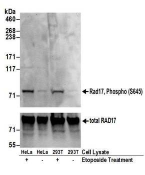 Rabbit anti-Phospho Rad17 (S645) Antibody