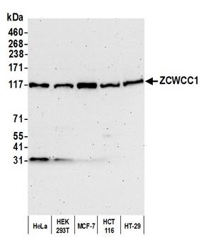 Rabbit anti-ZCWCC1 Antibody