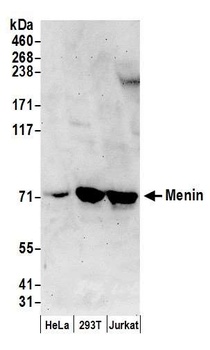 Rabbit anti-Menin Antibody