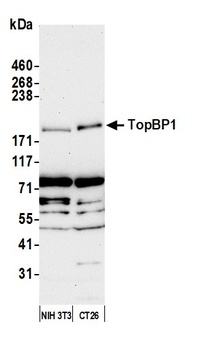 TopBP1 Antibody