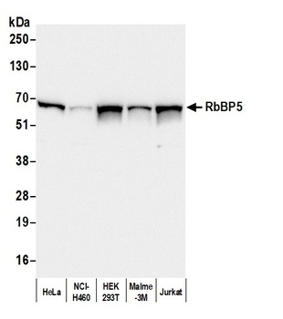 RbBP5 Antibody