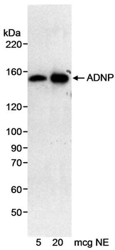 Rabbit anti-ADNP Antibody