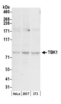 Rabbit anti-TBK1 Antibody