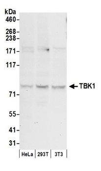 TBK1 Antibody