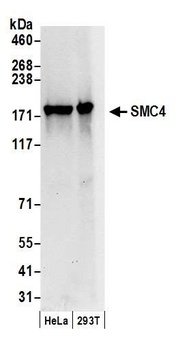 Rabbit anti-SMC4 Antibody