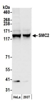 Rabbit anti-SMC2 Antibody