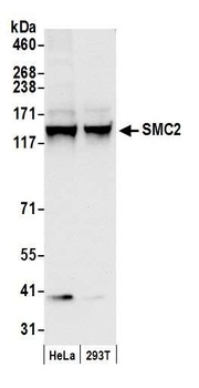 SMC2 Antibody