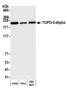 Topo II Alpha Antibody