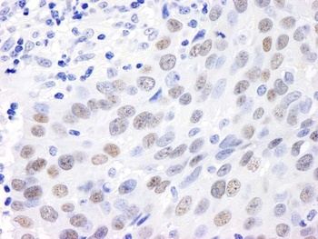Rabbit anti-MDC1 Antibody