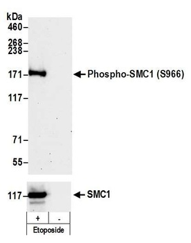 SMC1, Phospho (S966) Antibody