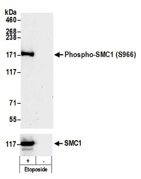 Rabbit anti-Phospho SMC1 (S966) Antibody