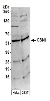 CSN1 Antibody