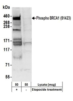 BRCA1, Phospho (S1423) Antibody