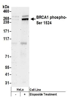 BRCA1, Phospho (S1524) Antibody