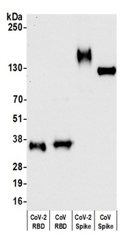 SARS-CoV-2 Spike RBD Antibody