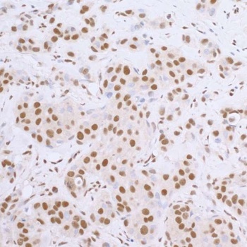 Goat anti-Rabbit IgG Heavy and Light Chain Highly Cross-Adsorbed Antibody (HRP)