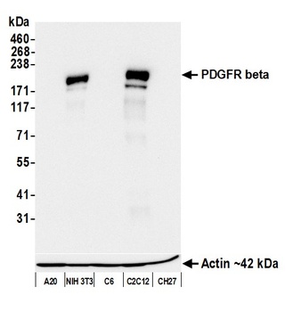 PDGFR beta Antibody