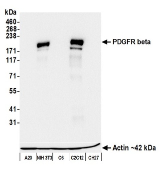 Rabbit anti-PDGFR beta Recombinant Monoclonal Antibody