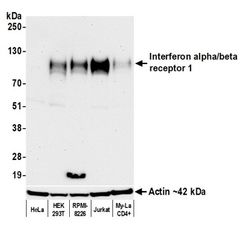Rabbit anti-Interferon alpha/ beta receptor 1 Recombinant Monoclonal Antibody
