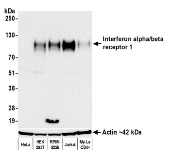 Interferon alpha/beta receptor 1 Antibody