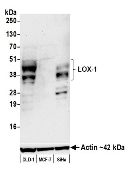 LOX-1 Antibody