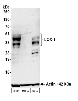 Rabbit anti-LOX-1 Recombinant Monoclonal Antibody