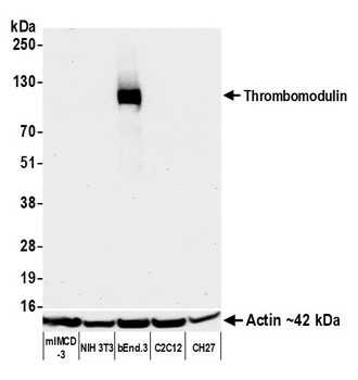 Rabbit anti-Thrombomodulin Recombinant Monoclonal Antibody