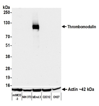 Thrombomodulin Antibody