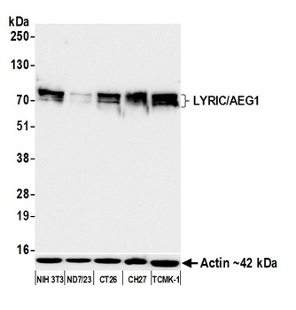 Rabbit anti-LYRIC/AEG1 Recombinant Monoclonal Antibody