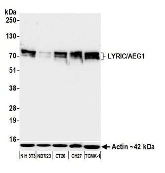 LYRIC/AEG1 Antibody