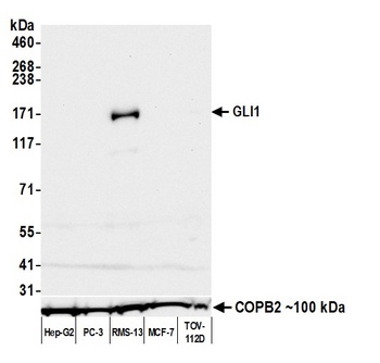 Rabbit anti-GLI1 Recombinant Monoclonal Antibody