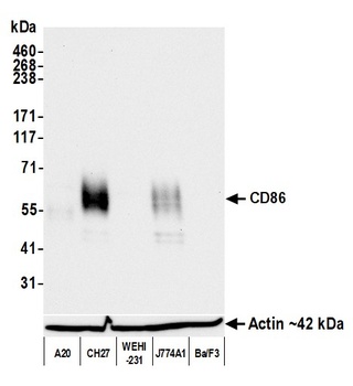 Rabbit anti-CD86 Recombinant Monoclonal Antibody