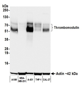 Thrombomodulin Antibody