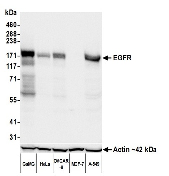 Rabbit anti-EGFR Recombinant Monoclonal Antibody