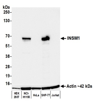 Rabbit anti-INSM1 Recombinant Monoclonal Antibody