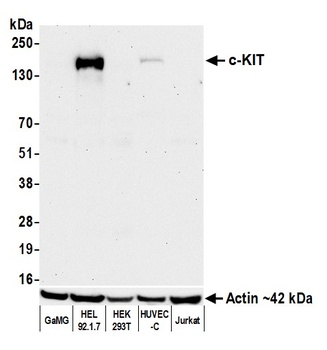 Rabbit anti-c-Kit Recombinant Monoclonal Antibody
