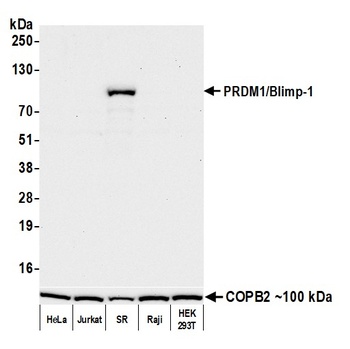 PRDM1/Blimp-1 Antibody