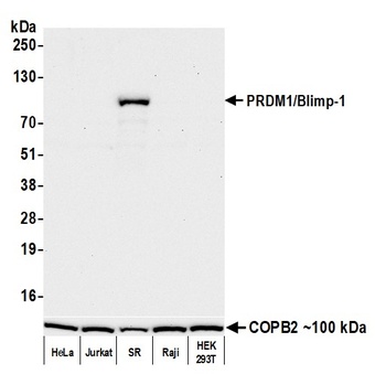 Rabbit anti-PRDM1/Blimp-1 Recombinant Monoclonal Antibody