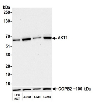 AKT1 Antibody